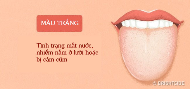 Tư vấn - Màu sắc lưỡi tiết lộ các vấn đề sức khỏe  (Hình 2).