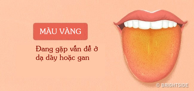 Tư vấn - Màu sắc lưỡi tiết lộ các vấn đề sức khỏe  (Hình 2).